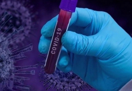 Шымкентте коронавирус жұқтырған 28 жағдай тіркелді