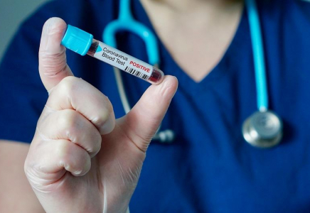 Елімізде өткен тәулікте 244 адамнан коронавирус анықталды  