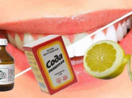 ​Тісіңіз САРҒЫШ па? АҒАРТУҒА болады