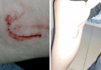 Көкшетауда 15 жастағы қызды иттер талап тастады (видео)