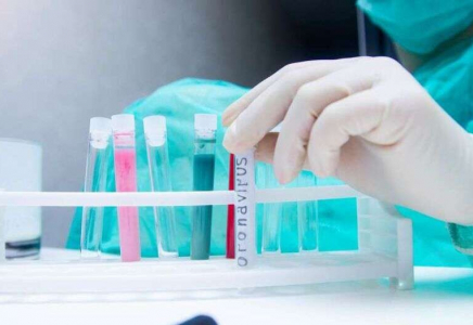 Елімізде өткен тәулікте коронавирус жұқтырғандар саны күрт өсті