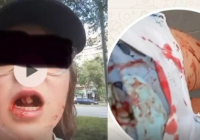 Жақ сүйегі сынып, екі тісі түсіп қалған: Қызды қағып, қашып кеткен электровелосипед жүргізушісі ұсталды 