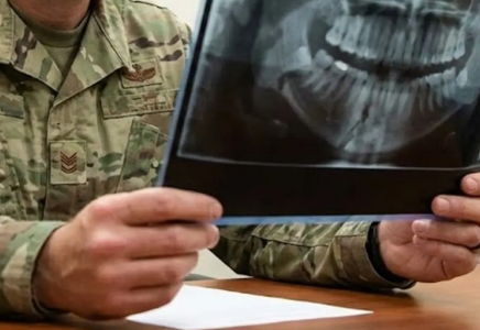 Жамбыл облысында әскери бөлімдегі жанжал: сарбаздың жақ сүйегі сынған