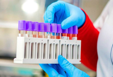 Елімізде өткен тәулікте коронавирус жұқтырғандар саны азайды