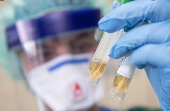 Түркістан облысында коронавирус жұқтыру жағдайы 79 %-ға төмендеді