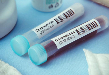 Елімізде өткен тәулікте 165 адамнан коронавирус анықталды