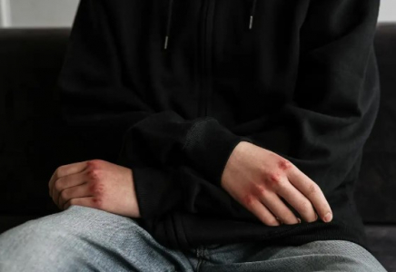 Ақмола облысында жол апатынан 15 жастағы жасөспірім көз жұмды
