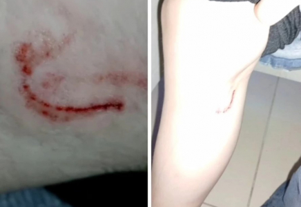 Көкшетауда 15 жастағы қызды иттер талап тастады (видео)