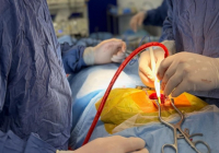 Шымкентте жоғары технологиялы нейрохирургиялық операция сәтті өтті 