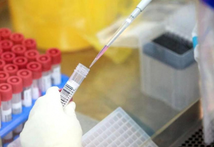 Солтүстік Кореяда бір тәулікте 96 мың адамнан безгек анықталды- БАҚ
