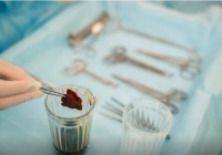 ШҚО-да үйде сүндеттелген бірнеше бала ауруханаға түсті 