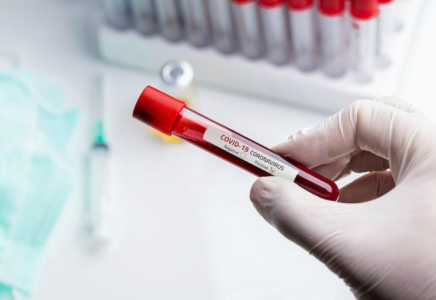 Шымкентте коронавирус жұқтырғандар саны 22-ге артты