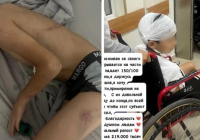 Балқашта 8 жасар баланы ұрды деп күдікке ілінген ер адам ұсталды