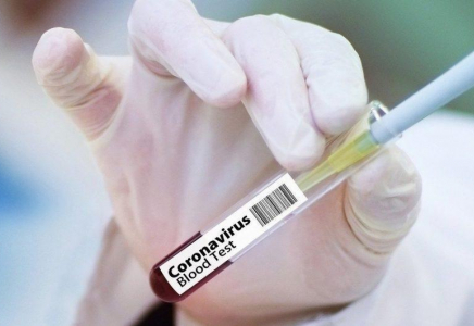 Елімізде қауіпті індет жұқтырғандар саны 90 мыңнан асты