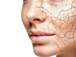 ​Бет терісі құрғап, ЖАРЫЛСА...