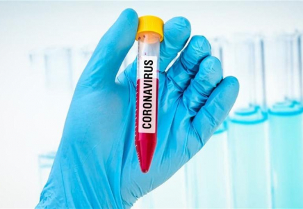 Елімізде коронавирус жұқтырғандар саны 3063 болды  