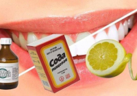 ​Тісіңіз САРҒЫШ па? АҒАРТУҒА болады