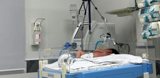 Шымкентте дәрігерлер сирек кездесетін диагнозбен туылған нәрестеге күрделі ота жасап, өмірін сақтап қалды