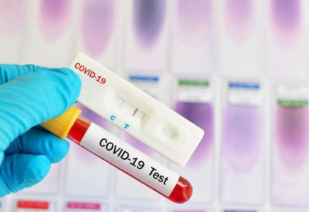 Қазақстанда коронавирус жұқтырғандар саны күрт өсті