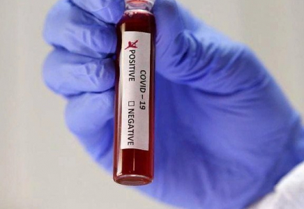 Шымкентте өткен тәулікте 22 адамнан коронавирус анықталды