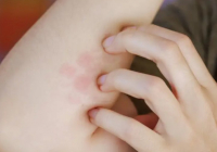 “Бір қабатта тұрған“: Петропавлда сегіз студент ауруханаға түсті