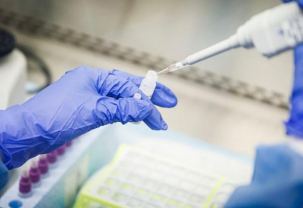 Шымкентте күніне үш жарым мың ПТР тестін жасауға мүмкіндік бар 