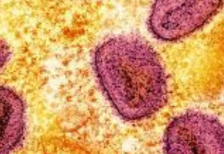 Үндістанда маймыл шешегінің жаңа қауіпті штаммы анықталды