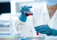 Батыс Қазақстан облысында шошқа тұмауы да тіркелді