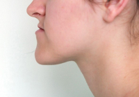 Иектің алға шығуы сақаулыққа апарады