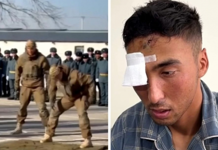 Жамбыл облысында әскери қызметкер басына шыны бөтелке жарып, бір көзінен айырылды