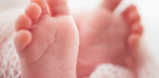 Дәрігерлер салмағы 730 грамм жаңа туған сәбидің өмірін сақтап қалды