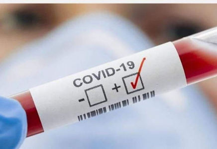 Шымкентте 41 жастағы әйел коронавирус жұқтырды