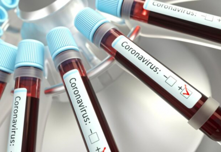 Қазақстанда өткен тәулікте коронавирус жұқтырғандар саны төмендеді