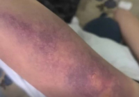 Қарағандыда бір топ жасөспірім қыз баланы соққыға жықты 