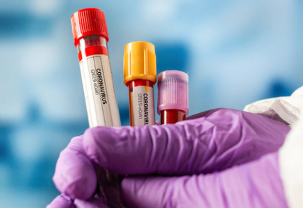 ШЫМКЕНТ: Өткен тәулікте 21 адамнан коронавирус анықталды