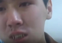 Әскердегі соққы: Жақ сүйегі сынған сарбазды туыстарынан жасырған 