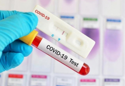 Қазақстанда тағы 47 адам коронавирус жұқтырды
