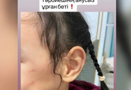 Астаналық әйел жекеменшік балабақша қызметкерін баланы ұрып-соқты деп айыптады